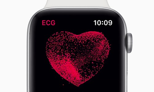 apple watch 4 heart health ecg screenshot