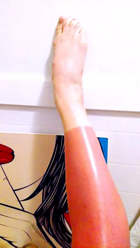 pleated jeans sunburn on lower leg against a white wall near pop-art paiting