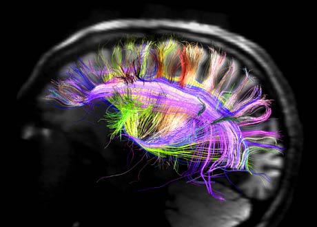 rainbow brain connectome map van j weeden human connectome project